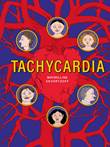 Maybelline Skvortzoff Tachycardia
